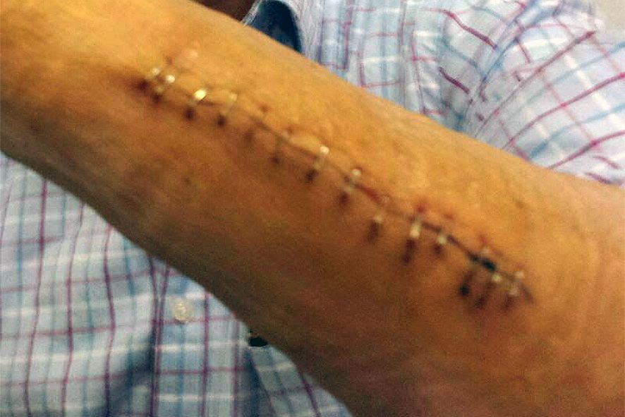 \"Em van destrossar el braç, i amb 2.400 euros no em taparan la boca\"