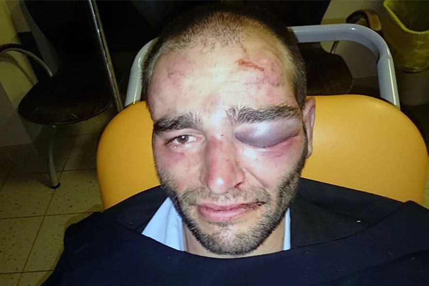 Jugadors de rugbi denuncien la manca de suport de Govern i la federació dos anys després de ser agredits a Letònia