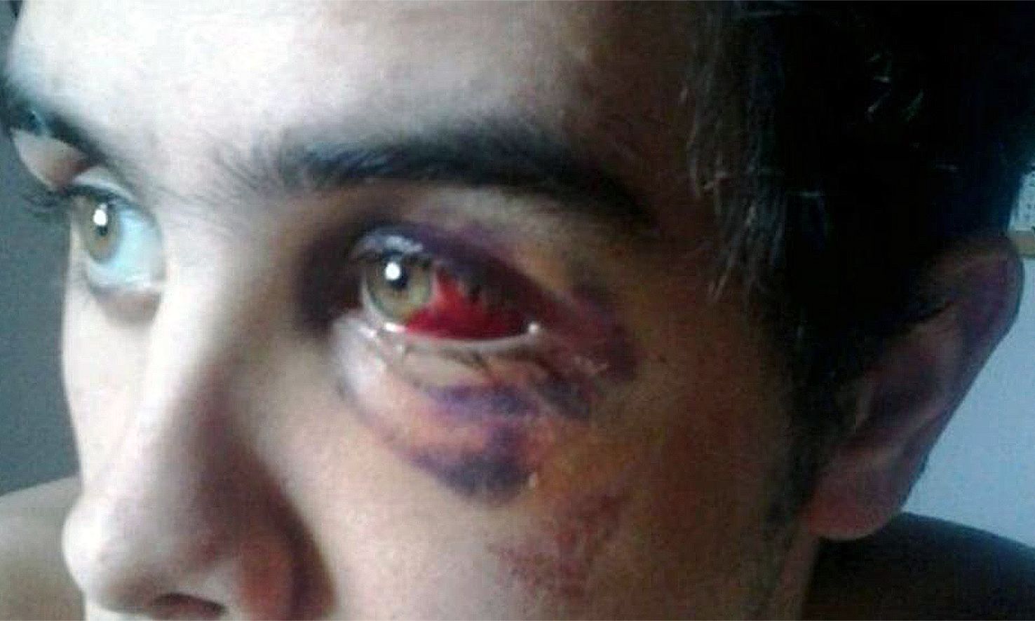 La fiscalia considera que no hi va haver xenofòbia en una batussa que va passar fa més de tres anys a la Massana