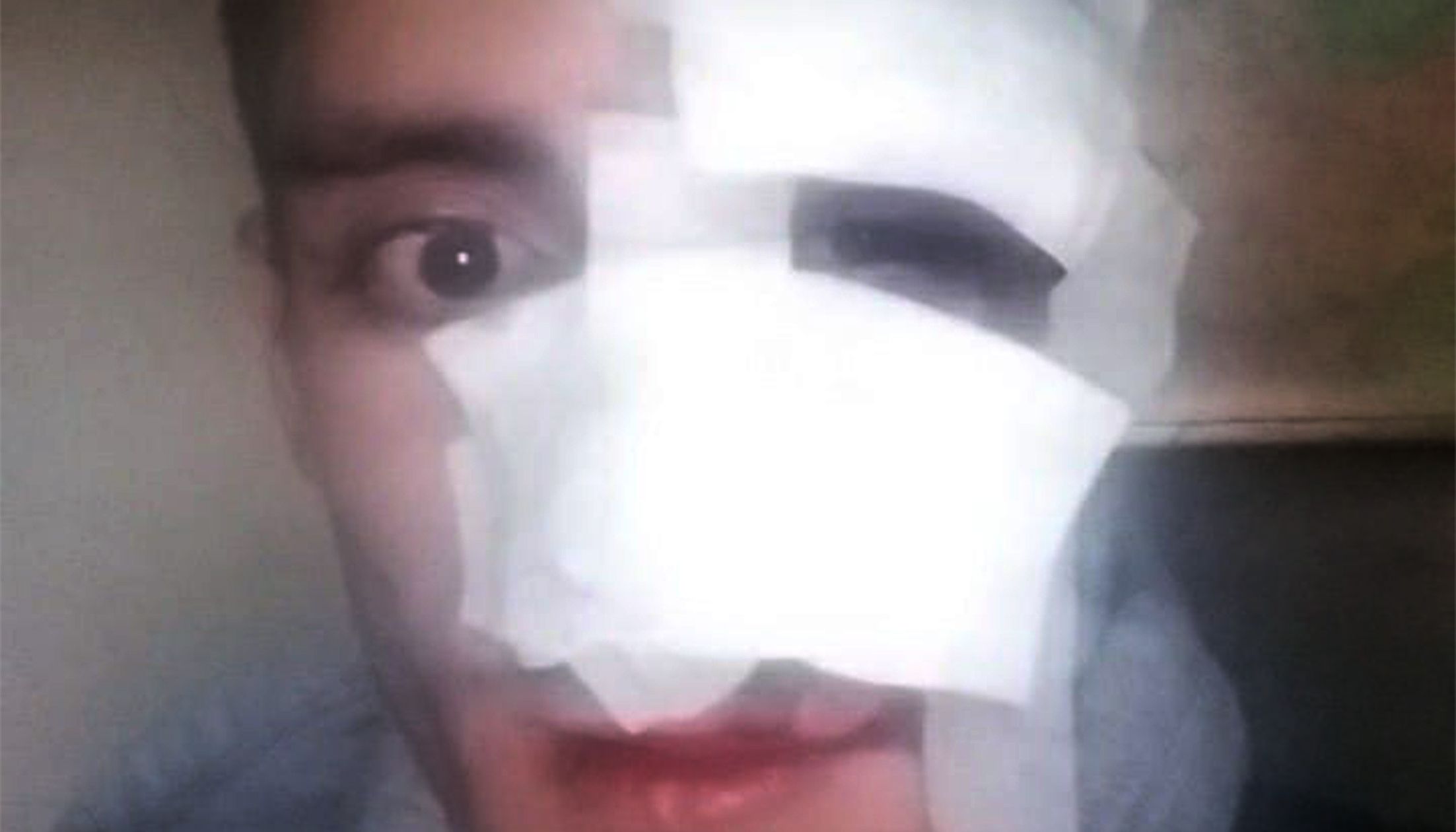 Aspecte del rostre del jove ferit un parell de dies després dels fets.