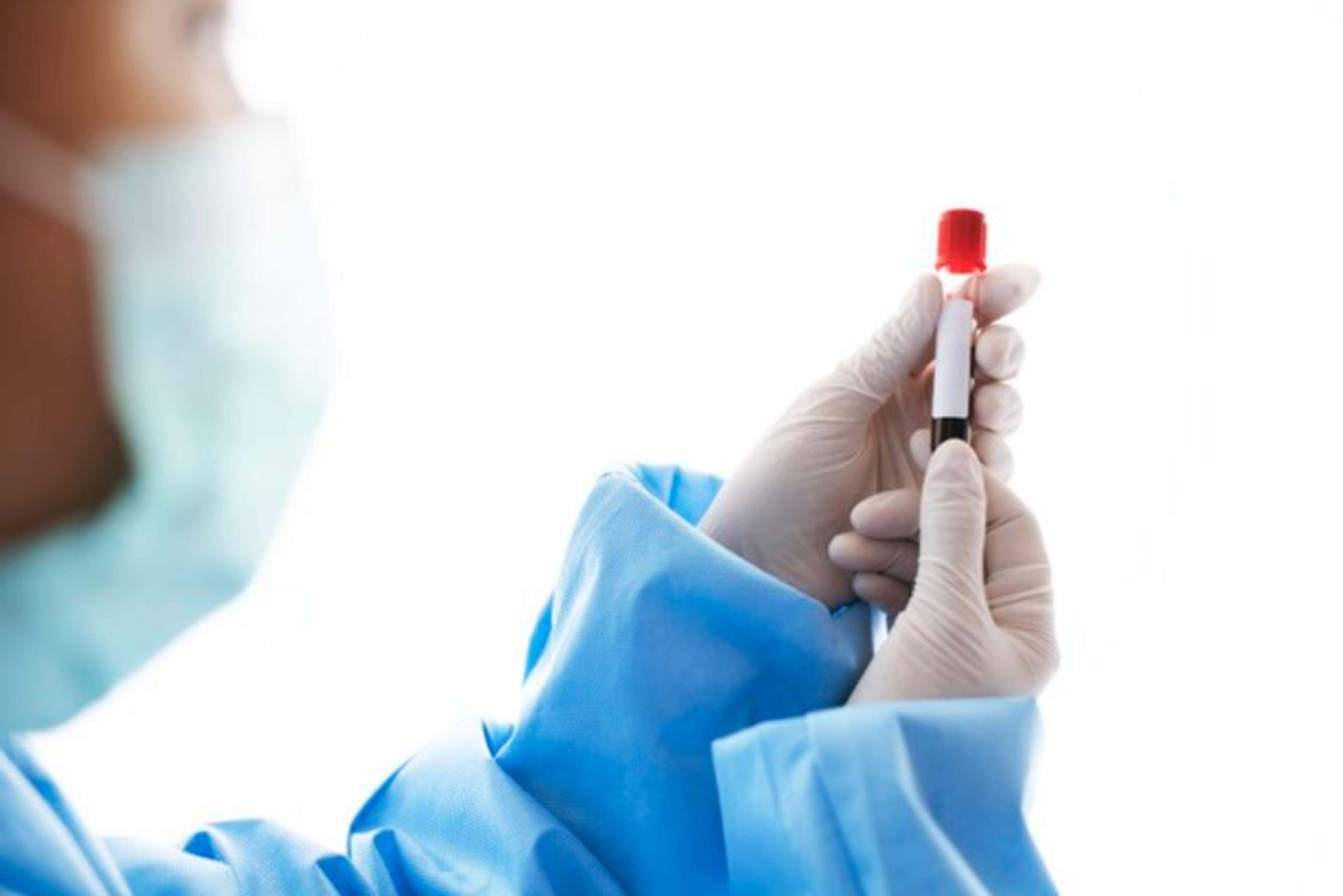 Una anàlisi de sang en el marc de les proves de seguiment oncològic.