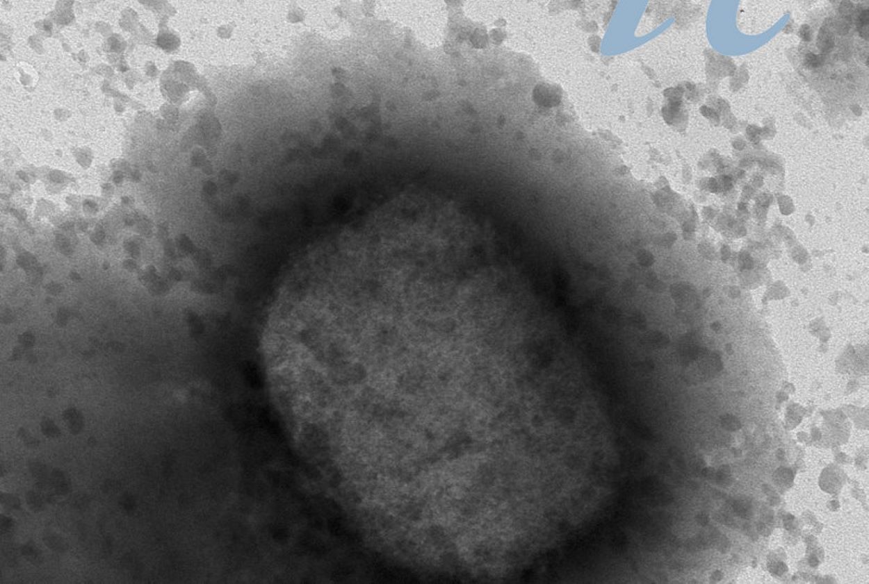 El virus de la verola del mico vist al microscopi electrònic.