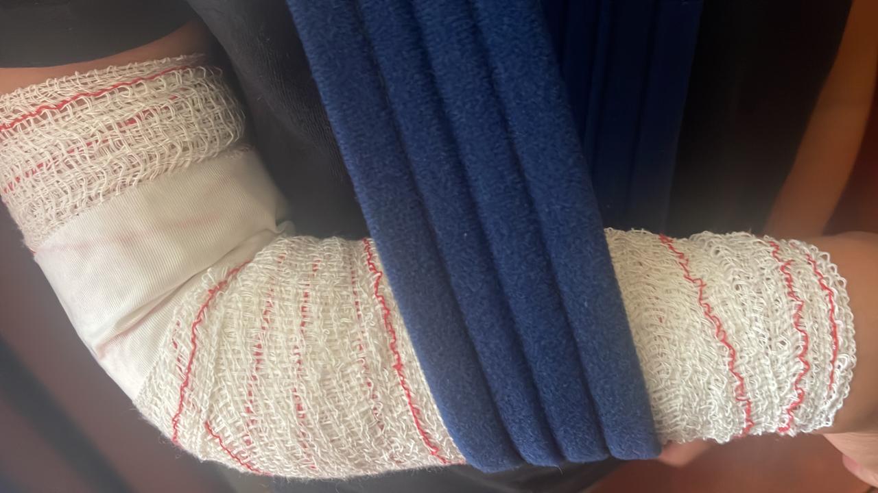 El nen mostra l'embenat 