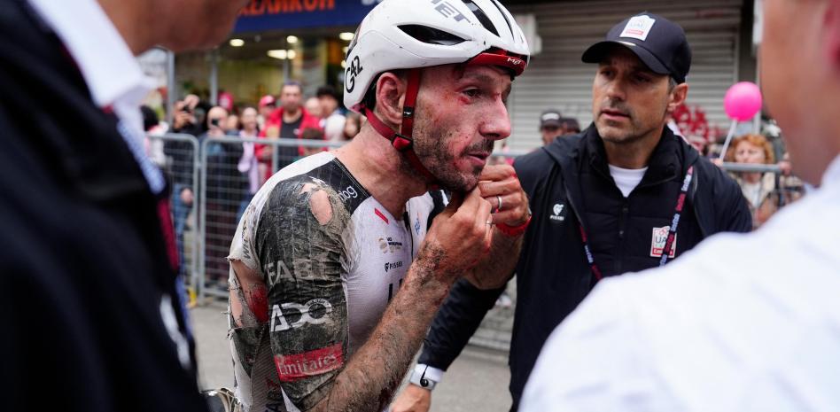 Un dels que era favorit a la classificació general, Adam Yates, amb la cara plena de sang després de la caiguda. 