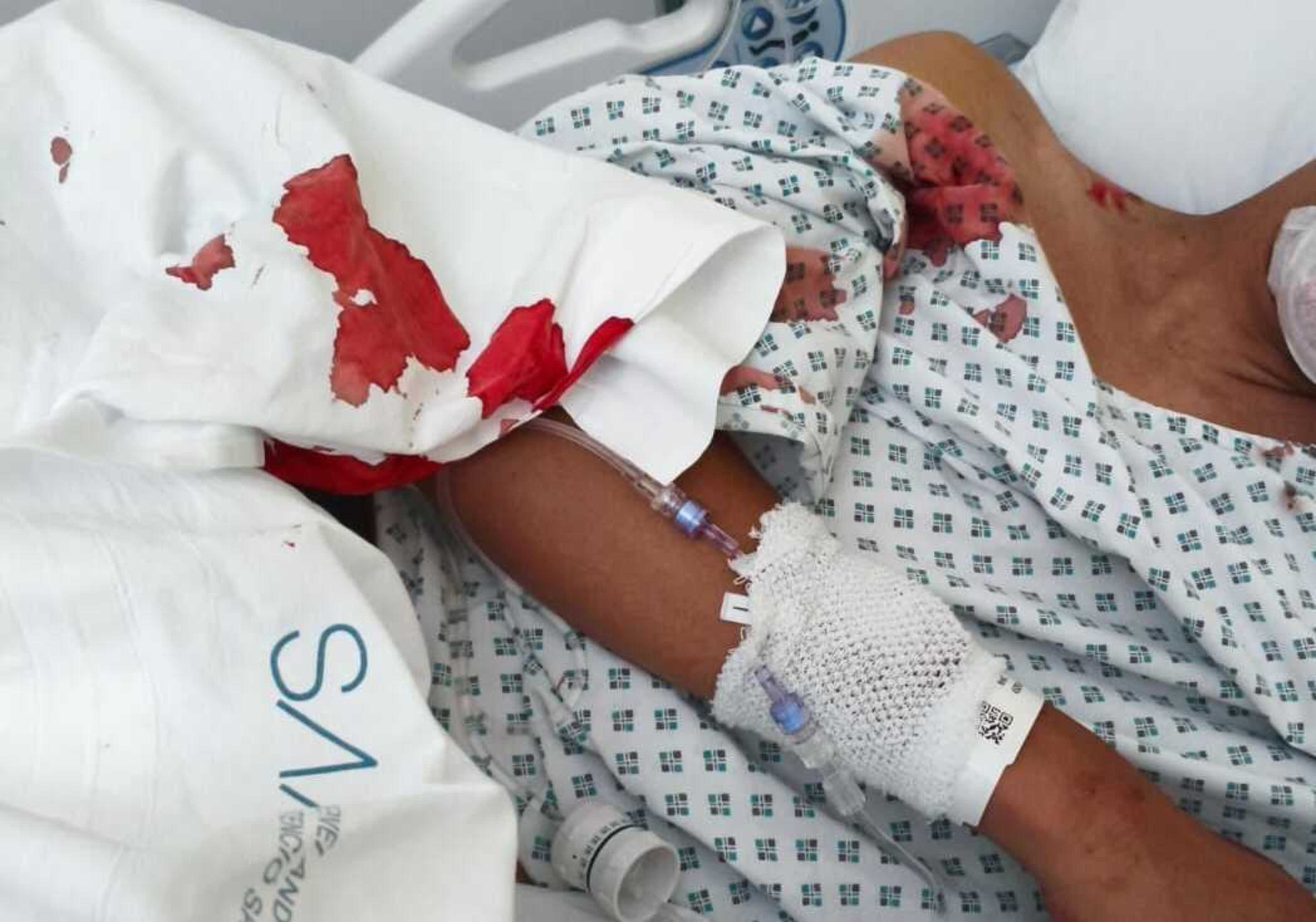 El noi ingressat a l'hospital abans de passar pel quiròfan.