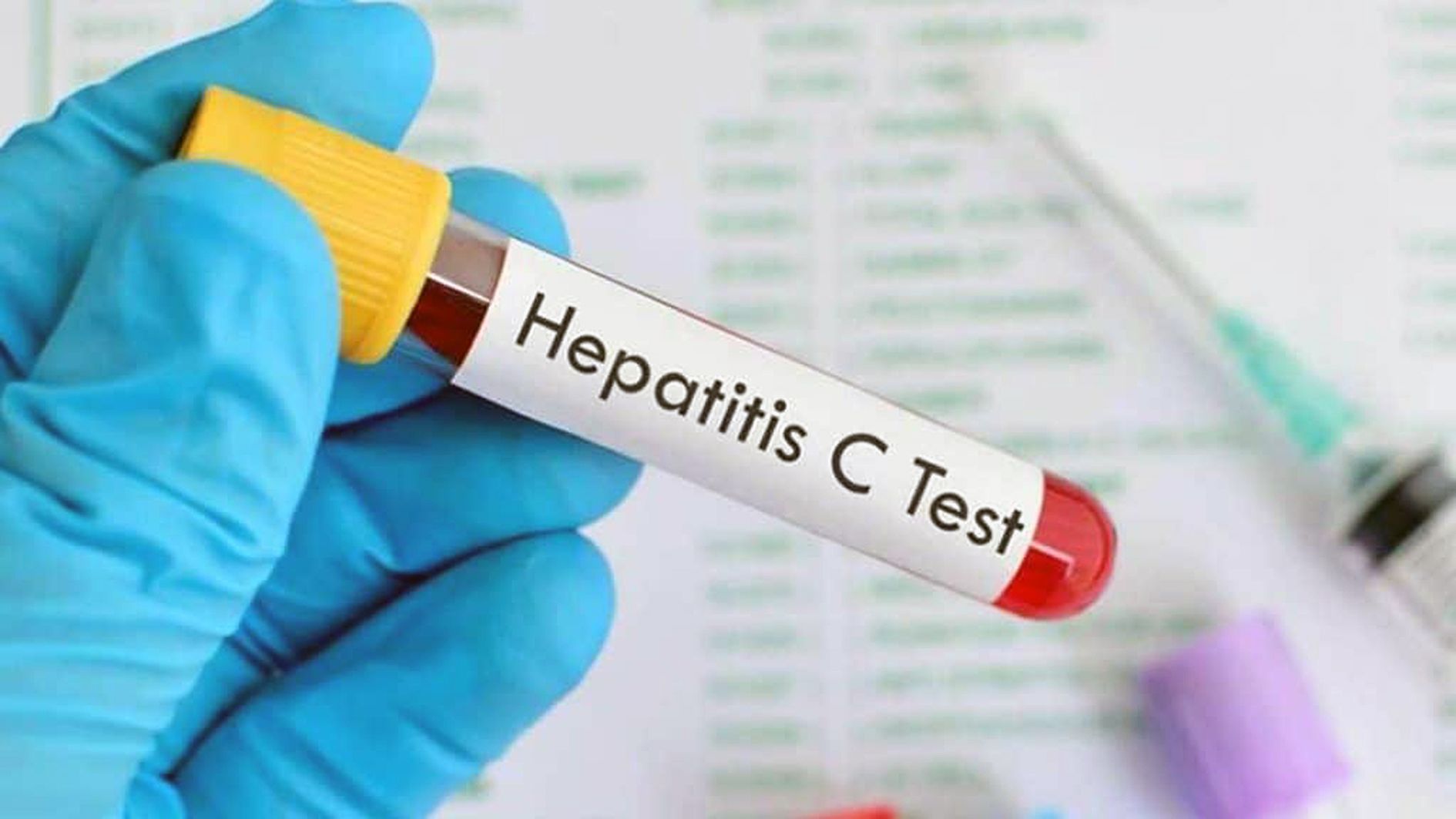 Un vial per fer un test d'hepatitis C.